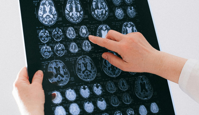 T9HC und kognitive Gesundheit: Wie es Fokus und Stimmung beeinflusst